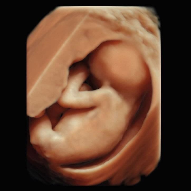 Früher Organultraschall